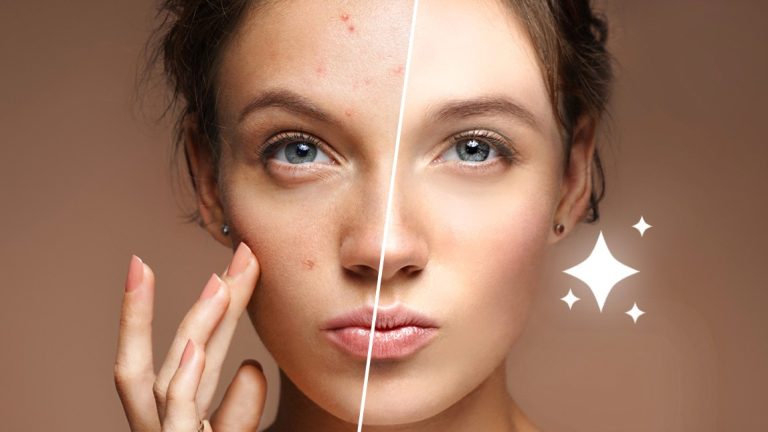 How to Edit Oily Skin on Iphone
